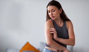 Mujer que ha sufrido una picadura