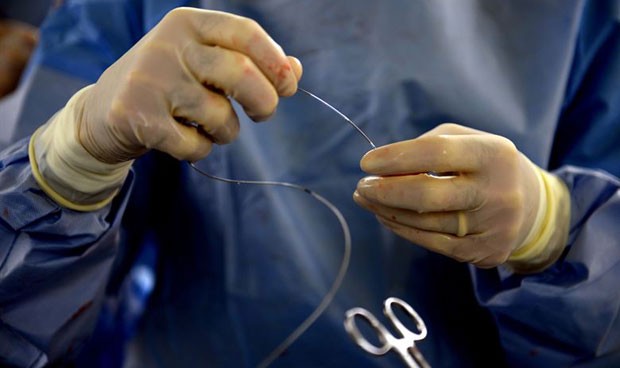 Pique entre cirujanos e intervencionistas por los 'implant files'
