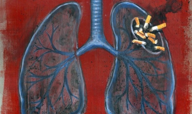Primaria advierte que el cáncer de pulmón será el más mortífero en mujeres
