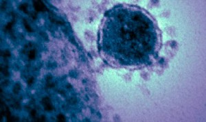 Primer caso de coronavirus fuera de Asia confirmado