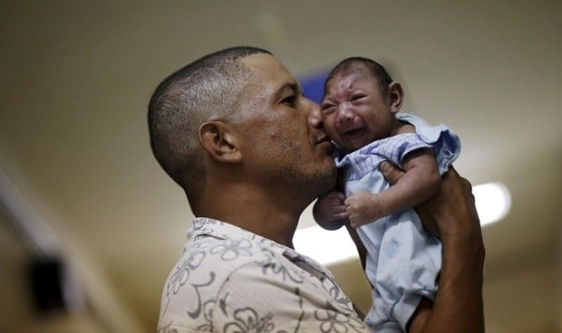 Primer caso de microcefalia por zika en España