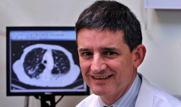 Quirónsalud ofrece un programa de detección precoz de cáncer de pulmón
