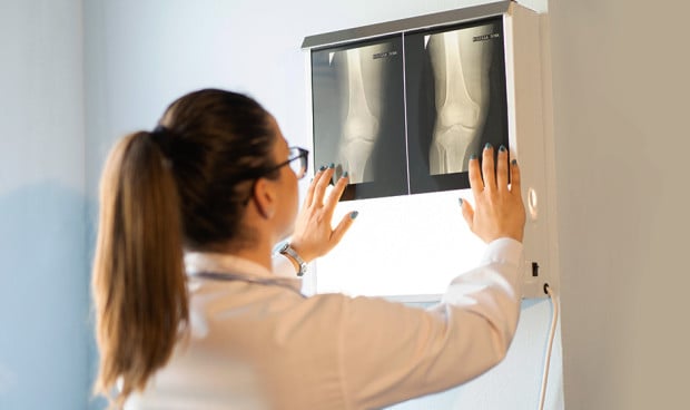 Seram habla del papel clave de la radiología para la detección precoz de tumores óseos.