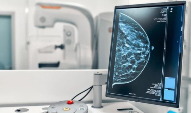 La mamografía con contraste permite mayor rapidez, accesibilidad y capacidad de detección en un solo acto diagnóstico, según especialistas en mama