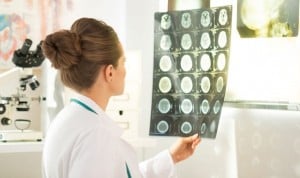 Radiología estandariza la tomografía ante el traumatismo craneoencefálico
