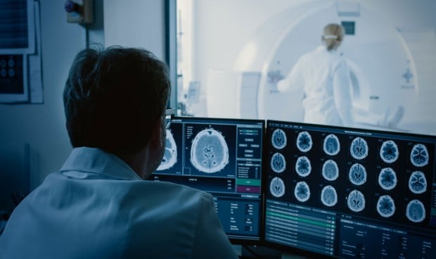 Radiología reivindica su papel en el diagnóstico del ictus