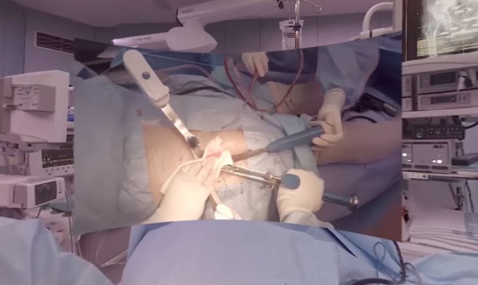 Realidad virtual en el quirófano: Así forma Vall d'Hebron a sus cirujanos