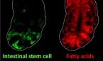 Relacionan las células intestinales que queman grasa con el cáncer de colon