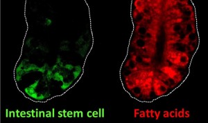 Relacionan las células intestinales que queman grasa con el cáncer de colon