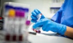Roche impulsa cerca de 300 ensayos clínicos con 8.500 pacientes