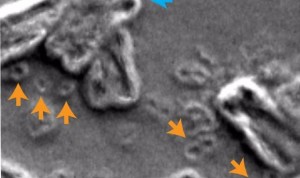 La ruptura de los cromosomas hace crecer a las células cancerosas