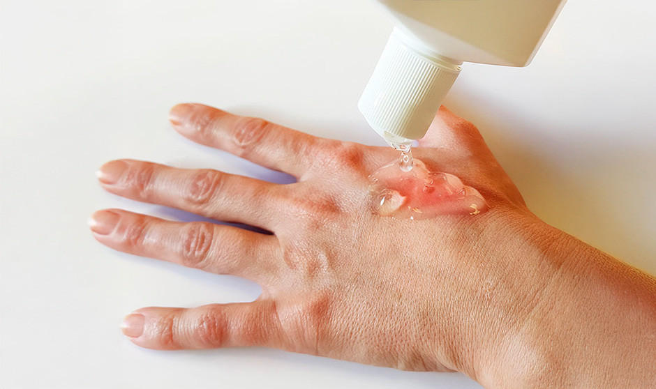 La Aemps ordena retirar productos para heridas y quemaduras de la marca MediHoney.