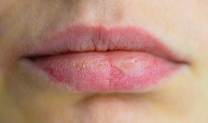 La Aemps ha emitido una alerta para retirar de inmediato un conocido enjuague para la sequedad bucal.