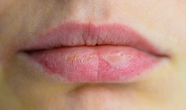 La Aemps ha emitido una alerta para retirar de inmediato un conocido enjuague para la sequedad bucal.