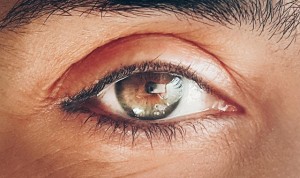 Sanitas conciencia sobre la importancia de la detección precoz del glaucoma