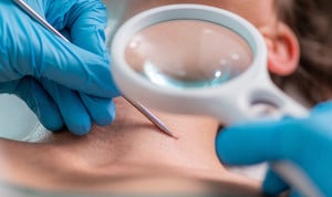 Un dermatólogo atendiendo a un paciente.