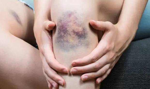 Sobi lanza la campaña "Desenmascara la PTI" para concienciar en su impacto