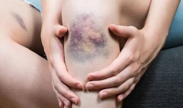 Sobi lanza la campaña "Desenmascara la PTI" para concienciar en su impacto