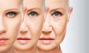 Tener acné retrasa el envejecimiento de la piel