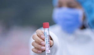 Test en saliva o antígenos: qué prueba es más fiable para detectar Ómicron