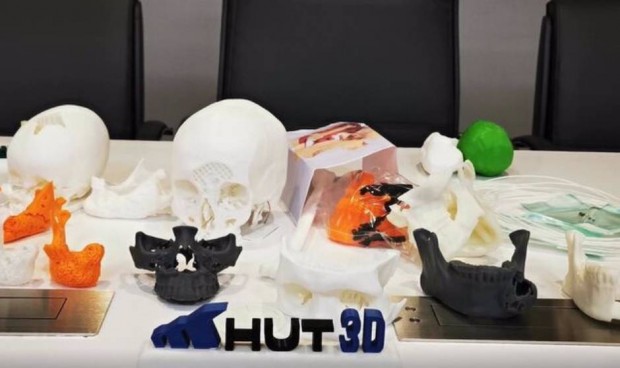 Torrecárdenas optimiza cirugías con la unidad de Impresión 3D y Biomodelado