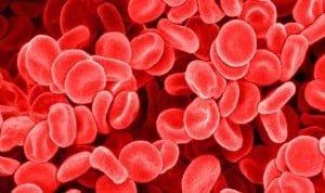 Trasplante de células madre, opción prometedora en anemia falciforme