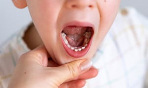 Uno de cada cinco menores sufre dolores dentales frecuentes debido al estado de su boca