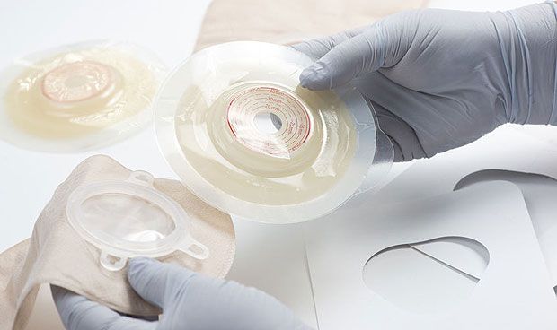 Un 5% de los pacientes de Crohn y colitis ulcerosa tiene una ostomía