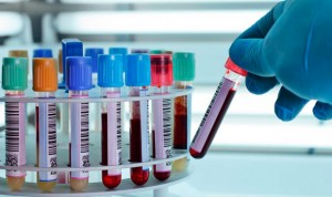 Un análisis de sangre detecta si el cáncer de ovario responde a quimio
