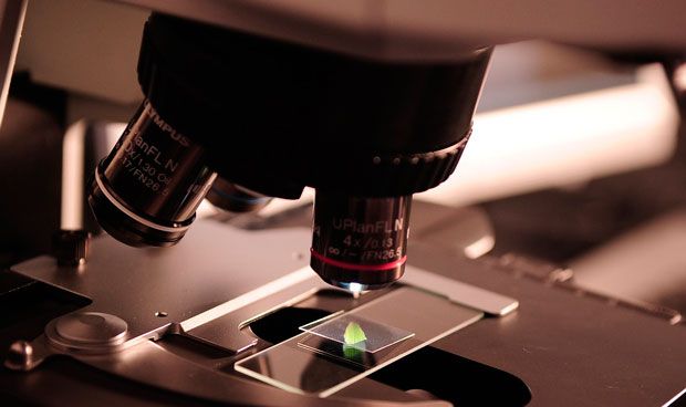 Un biomarcador abre el camino a la personalización en cáncer de próstata