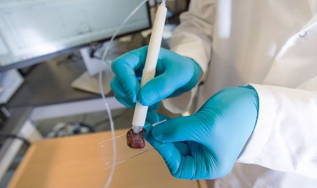 Un 'bolígrafo' detecta las células cancerosas circundantes a un tumor