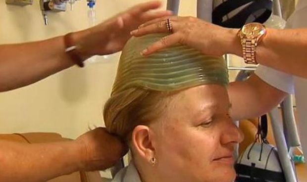 Un casco logra evitar que caiga el pelo por la quimioterapia