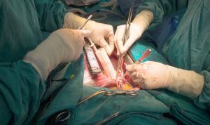Un cirujano admite que marcó sus iniciales en el hígado de dos pacientes