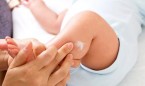 Un estudio recomienda usar crema hidratante dos veces al día para el eczema