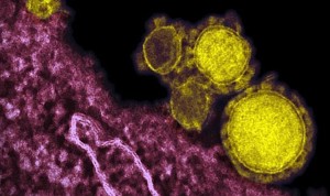 Un estudio sugiere mayor eficacia de anticuerpos nasales contra el Covid