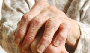Un estudio vincula la artrosis a un mayor riesgo de infarto