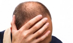 Un estudio vincula por primera vez la contaminación a la pérdida de pelo