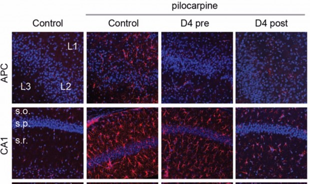 Un grupo de neurocientíficos descubre un fármaco para tratar la epilepsia