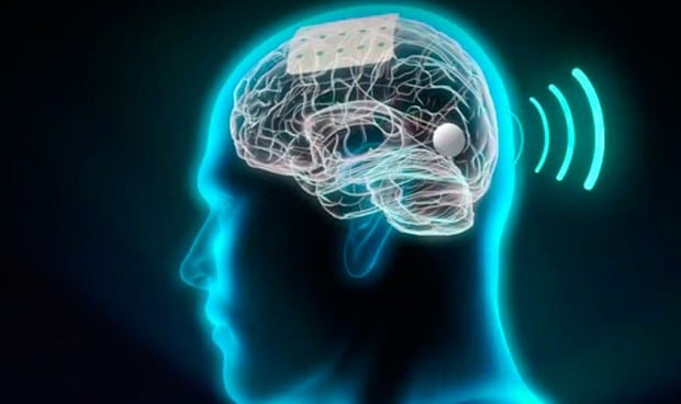Un implante 'made in Spain' permite acceder a lo más profundo del cerebro
