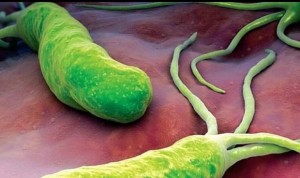 Un 'interruptor molecular' desencadena la infección por Helicobacter pylori