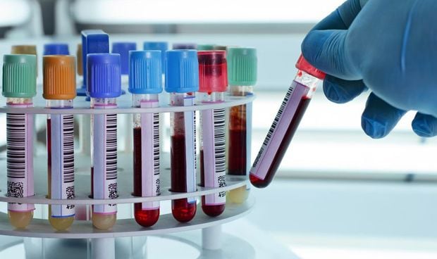 Un nuevo anlisis de sangre detecta ocho tipos de cncer