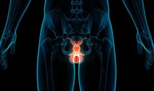 Científicos británicos desarrollan una prueba diagnóstica de cáncer de próstata con solo un análisis de sangre