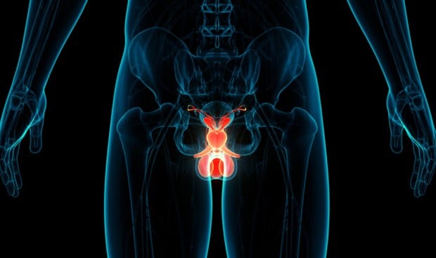 Científicos británicos desarrollan una prueba diagnóstica de cáncer de próstata con solo un análisis de sangre