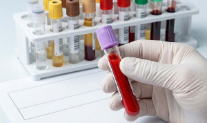 Hallan un biomarcador que distingue tumor y necrosis en metástasis cerebral