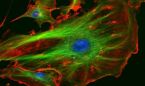 Un nuevo método convierte células de la piel en células madre pluripotentes