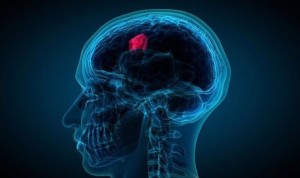Un nuevo método elimina tumores cerebrales al matarlos de 'hambre'
