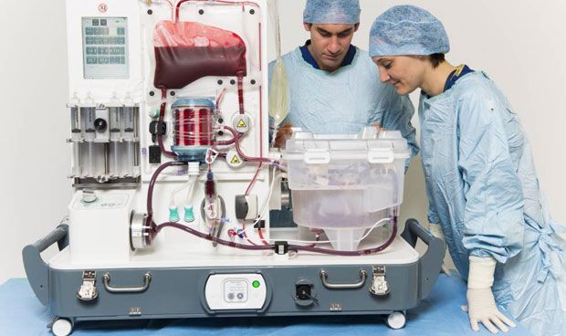 Un nuevo sistema mejora la conservación de los hígados para trasplantes