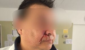 Un paciente agrede brutalmente a un médico en un ambulatorio de Mallorca