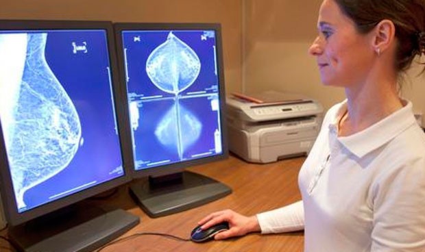Un programa diagnostica el 99% de los tumores en las mamografías