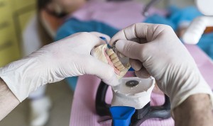 El Consejo General de Dentistas presidido por Óscar Castro anuncia que un protésico dental ha sido condenado por intrusismo laboral.